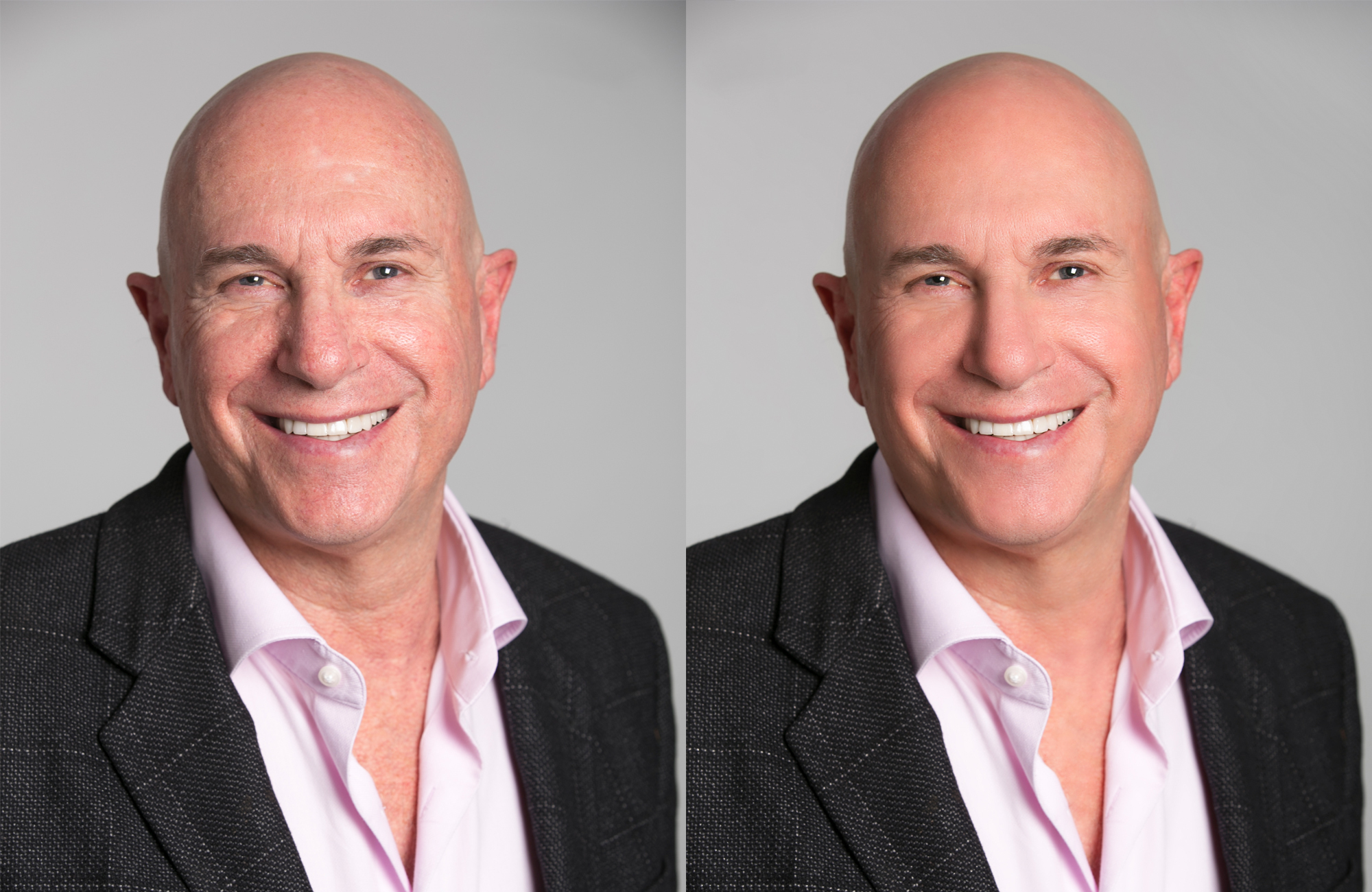 Headshort retouching